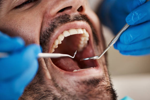 Best Walk-In Emergency Dental Services in Roseville, MI